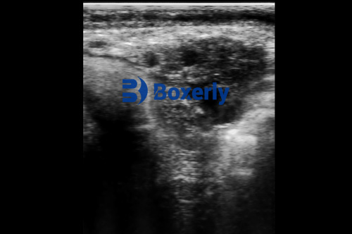 Optimizing Ovum Pick-Up Protocols for Enhanced Embryo Production in Livestock