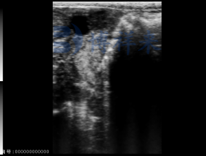 Bovine follicle