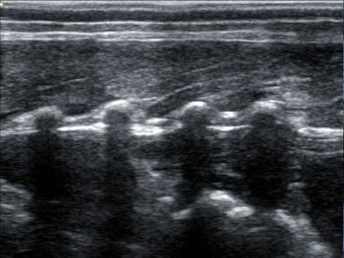 BXL-DZ20 Determination of pig backfat thickness and loin area