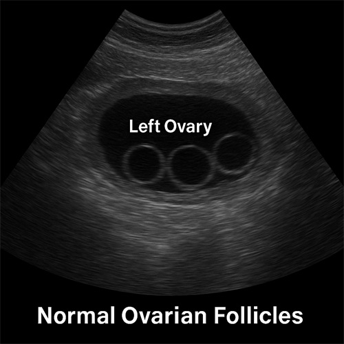 Detection of Abnormal Follicles During Estrus in Female Dogs Using Veterinary Ultrasound Equipment