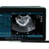 BXL-DZ20 Multifunctional Veterinary OPU Instrument