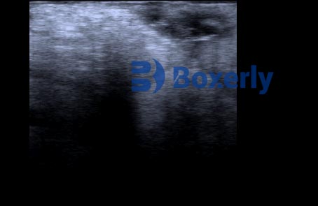 Top Benefits of a Portable Livestock Ultrasound Machine