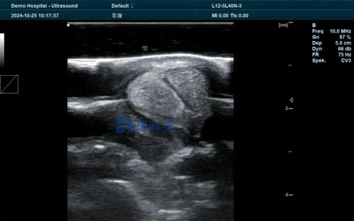Horse's tendon ultrasound Ultrasound Imaging: A Key Tool in Veterinary Medicine