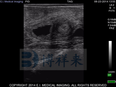 When Is the Earliest You Can Ultrasound a Cow for Pregnancy?