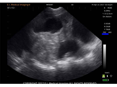 Ultrasound Imaging Characteristics During Sow Pregnancy