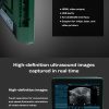 Veterinary Color Doppler Ultrasound Diagnostic  BXL-DZ20